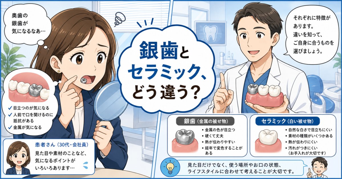 奥歯の銀歯が気になる方へ！セラミックとの費用や寿命の違いを解説