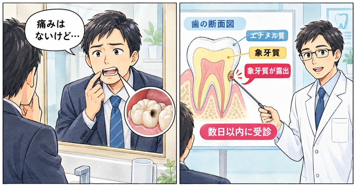 詰め物が取れたら受診は何日以内が目安?痛くない時の猶予期間
