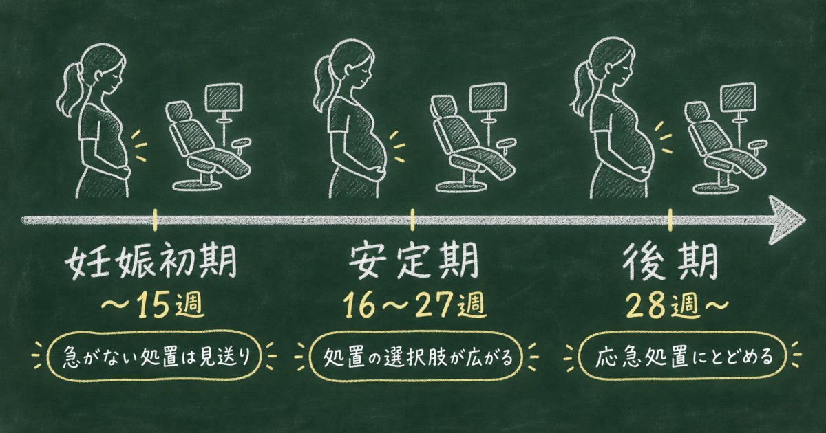 妊娠周期によって抜歯の判断はどう変わるのか