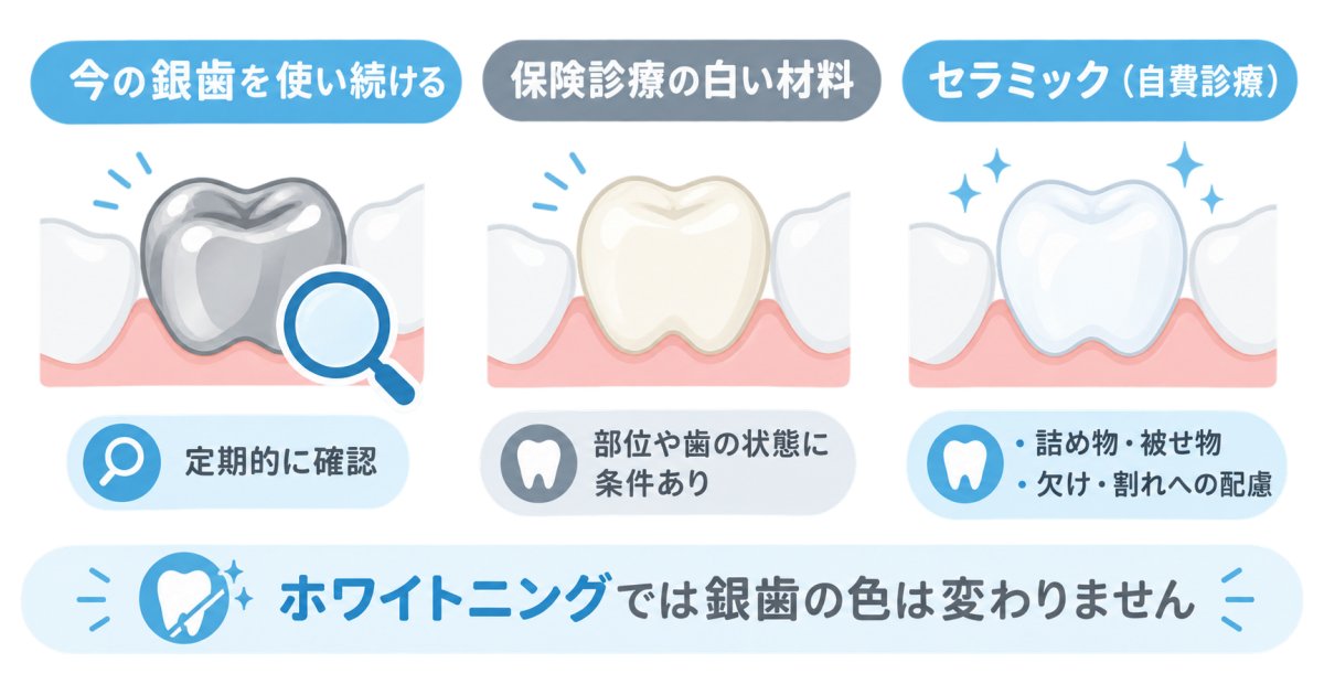 銀歯を白くするなら、セラミック以外も選べる?