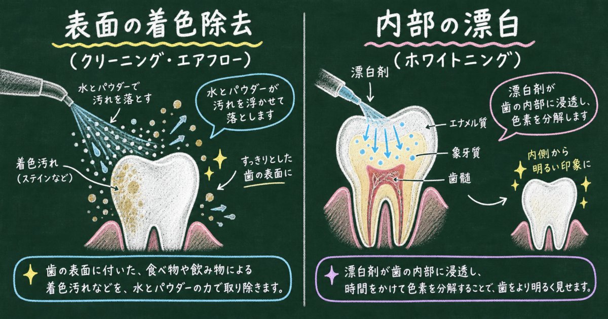 クリーニング・エアフローとホワイトニングで変えられる色の範囲の違い